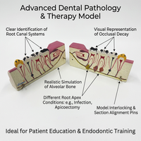 Modelo Anatómico Dental Patológico de Mandíbula Inferior con Visualización de Lesiones en Múltiples Dientes para la Enseñanza de Estomatología en Facultades de Medicina, con Certificación CE ISO