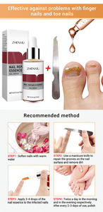 Sérum Réparateur d'Ongles <span class=keywords><strong>Anti</strong></span>-<span class=keywords><strong>Fongique</strong></span>, Élimine l'Onychomycose, Nourrissant et Éclaircissant pour les Soins des Mains, des Pieds et des Orteils - Product Image 6