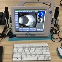 Sistema de Ultrasonido Oftalmológico EOMED A/B para Diagnóstico Ocular, Resultados de IOL, Imágenes B-scan, Modelo EUS2300S, 1 Año de Garantía