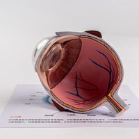 Modèle oculaire pathologique avec lentilles interchangeables pour la démonstration de la cataracte