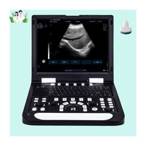 Ultrasonido de alta calidad, máquina de ecografía portátil, máquina de eco, máquina de ultrasonido USG - Product Image 1