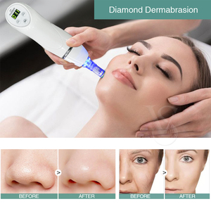 Portable 6 Tips Crystal Microdermabrasion Diamond Peeling Machine Blackhead Acné Eliminador <span class=keywords><strong>de</strong></span> arrugas Limpiador <span class=keywords><strong>de</strong></span> poros Característica para AU US - Product Image 5