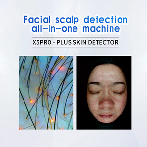 เครื่องวิเคราะห์ผิวหน้า X5 AI สำหรับรูขุมขน จุดด่างดำ ความชุ่มชื้น และความยืดหยุ่น |   เครื่องสแกนผิวหน้าสำหรับผู้เชี่ยวชาญในคลินิกเสริมความงาม - Product Image 5