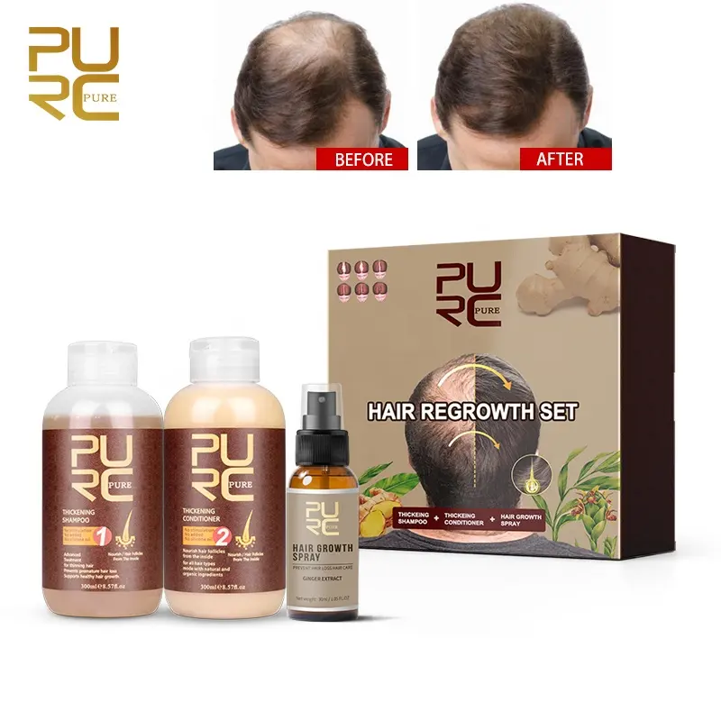 バイオチンジンジャーオイルサプリメントグロースヘアコンディショナー製品ヘアグロースエッセンシャルオイル男性用育毛