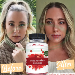 Gummies à l'astaxanthine OEM, blanchiment de la peau, qualité alimentaire naturelle, antioxydant en vrac, complément alimentaire de 12 mg pour hommes, produits de beauté - Product Image 2
