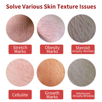 Crème Bio Anti-Vergetures Efficace – Meilleur Beurre Ventre pour l'Élimination des Vergetures et la Réparation Cutanée pour Femmes Enceintes