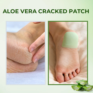 Mascarilla Exfoliante Herbal para Pies, con Aloe Vera y Lavanda, Hidratante para Pies Secos y Agrietados, Suaviza los Talones, Éxito de Ventas Transfronterizo - Product Image 2
