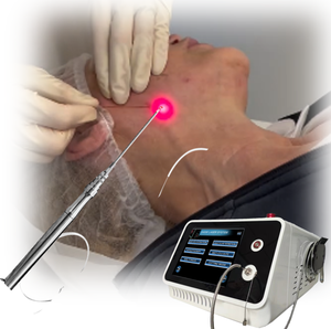 Máquina Láser de Endolifting de Doble Longitud de Onda 980nm 1470nm para Lifting Facial, Eliminación de Grasa y Reafirmación de la Piel - Product Image 2