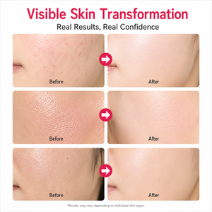 Hydrolyzed Collagen Lyophilized <b>Powder</b> Deep Hydration Cosmetic Ingredient - Product Image 2