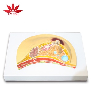 Del seno patologico modello di anatomia Modello di Pratica di Cura del seno modello anatomico - Product Image 3