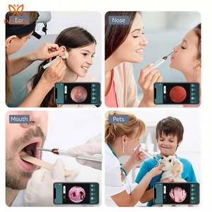 Hot Selling Visual Otoscope Connect Wireless <b>Ear</b> <b>Wax</b> <b>Removal</b> Tool Kit <b>Ear</b> Care Endoscope Camera Earwax Cleaner - Product Image 6