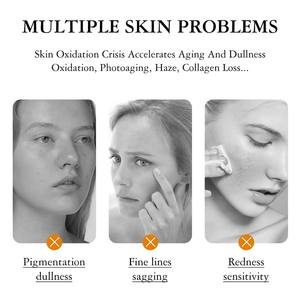 Suero Revitalizante Diario para la <span class=keywords><strong>Piel</strong></span> con Vitamina C y Niacinamida, Combate la Opacidad, el Acné, las Manchas Oscuras y las Líneas Finas para una <span class=keywords><strong>Piel</strong></span> Clara y Radiante - Product Image 4