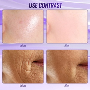Varita de Terapia de Alta Frecuencia para el Cuidado de la Piel, Lifting Facial para Uso Doméstico, Máquina de Terapia Cutánea - Product Image 6
