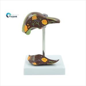 PVC病的肝臓モデルが一般的な肝および胆嚢障害を視覚化 - Product Image 1