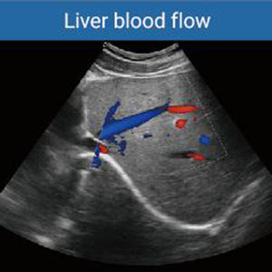 Alat diagnostik ultrasonik warna 3D/4D/5D, pemindai Ultrasound eksklusif portabel, peralatan Ultrasound - Product Image 4