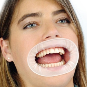 Retractores Dentales Desechables en Forma de O, Abridores Bucales de Goma Estériles para Higiene Bucal - Product Image 5