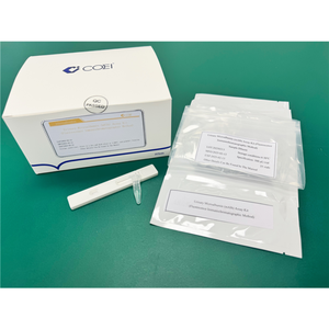 Malb Snelle Microalbumine-Testkit Voor Urine Maakt Gebruik Van Fluorescentie-Immunochromatografische Technologie Voor Het Opsporen Van Vroege Nierziekten - Product Image 3