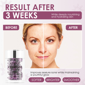Cápsulas de Suero de Ceramida al por Mayor, Hidratantes y Reparadoras para el Cuidado Facial, Antienvejecimiento y Antiarrugas - Product Image 5