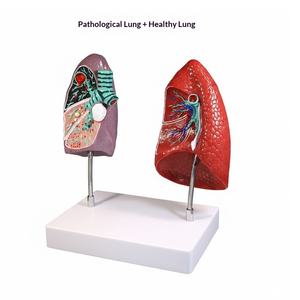 Matériel pédagogique pour le système respiratoire : Throat Heart Lungs, Segments pulmonaires codés par couleur, Structure des organes internes, Poumons malades, Modèle humain - Product Image 4