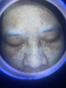   Appareil d'analyse de la peau du visage à lumière UV KN-9000C et lampe à bois portative, appareil d'analyse de la peau professionnel - Product Image 4