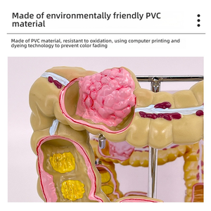 बड़ी आंत पैथोलॉजी मॉडल सिलिकॉन अंग और गैस्ट्रोइंटेस्टाइनल और कोलन रोग के लिए हेड मॉडल - Product Image 5