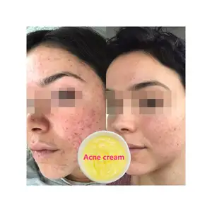 Produk baru pemutih Anti Keriput Bye noda menghilangkan bekas jerawat Bio Essence