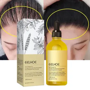 Label pribadi 100% Formula alami grosir nutrisi kulit kepala Perawatan Rambut rontok Serum Minyak penumbuh rambut