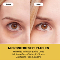 Masque pour les yeux à micro-aiguilles au collagène, marque privée OEM, patchs pour les yeux anti-rides, acide hyaluronique, patch pour les yeux à micro-aiguilles
