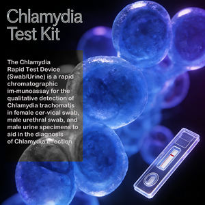 Approved <strong>Gonorrhea</strong> Chlamydia Trachomatis Antigen Rapid Std <strong>test</strong> <strong>Kit</strong> for Sexual Transmitted Disease - Product Image 4
