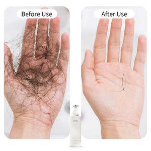 Vente en gros 250g de shampooing bio <span class=keywords><strong>anti</strong></span>-<span class=keywords><strong>chute</strong></span> de cheveux avec logo personnalisé shampooing <span class=keywords><strong>efficace</strong></span> pour le contrôle de la <span class=keywords><strong>chute</strong></span> des cheveux de marque privée - Product Image 2