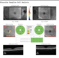 Équipement ophtalmologique à succès : Tomographe OCT optique Oct-500 – Prix compétitif