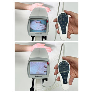 महिलाओं के लिए SY-F005-3 पोर्टेबल कोलेपोस्कोप अस्पताल हैंडहेल्ड कोलोस्कोप कैमरा - Product Image 3