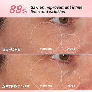 Crème pour les yeux anti-âge <span class=keywords><strong>coréenne</strong></span> à la niacinamide OEM, collagène soluble, acétate de tocophérol, PDRN de saumon, peptide rose, tube - Product Image 5