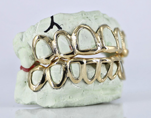 Framed Gold S925 <b>Silver</b> Open Face Grillz - Product Image 4