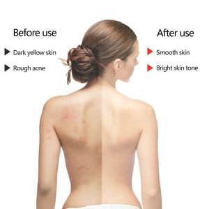 ขัดผิวด้วยเกลือทะเลขัดเท้าสำหรับขัดผิวขัดผิวด้วยถ่านกลิ่นสตรอเบอร์รี่อะโวคาโดกุหลาบขัดผิว - Product Image 5