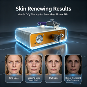 Machine portable de <span class=keywords><strong>carboxythérapie</strong></span> au CO2, équipement de beauté <span class=keywords><strong>pour</strong></span> l'élimination des vergetures, des cicatrices et des <span class=keywords><strong>cernes</strong></span>, <span class=keywords><strong>pour</strong></span> le soin du visage et du corps - Product Image 1