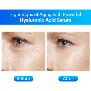 JMFREE Private Label Face Anti <strong>Aging</strong> Serum Niacinamide Hyaluronic Acid <strong>Vitamin</strong> C Skin Care Facial Serum - Product Image 6