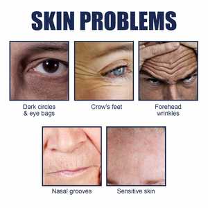 Parches Faciales para <span class=keywords><strong>Arrugas</strong></span> de Marca Privada East Moon Wholesale para Hombres, Atenúan las Líneas Finas, Suavizan la <span class=keywords><strong>Frente</strong></span>, Reafirman y Levantan - Product Image 5