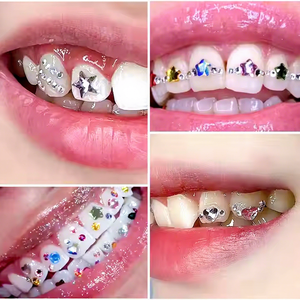 <span class=keywords><strong>Prix</strong></span> de gros brillant bricolage <span class=keywords><strong>dent</strong></span> gemmes sans plomb matériel dentaire 2mm forme ronde cristal <span class=keywords><strong>diamant</strong></span> <span class=keywords><strong>dent</strong></span> gemmes - Product Image 2