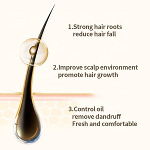 Shampooing <span class=keywords><strong>anti</strong></span>-chute à base de plantes bio vegan pour le traitement de la <span class=keywords><strong>calvitie</strong></span> prévenir la perte de cheveux favoriser la repousse des cheveux shampooing vente en gros - Product Image 4