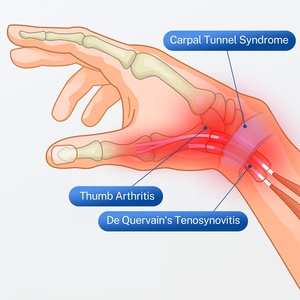 <span class=keywords><strong>2025</strong></span>, неопреновый фиксатор запястья - Product Image 4