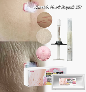 G căng Mark sửa chữa Kit bác sĩ công thức căng Mark kem mang thai chăm sóc da Kit cho vết sẹo quà tặng cho mẹ - Product Image 1