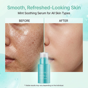 Sérum Visage Anti-Acné et Anti-Âge en Gros sous Marque Blanche, Soin Naturel et Bio à la Vitamine C et à l'Acide Azélaïque - Product Image 4