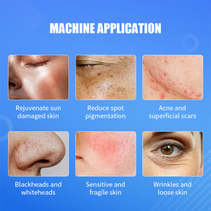 Professional Beauty Spa 14 in 1 Standing Hydra Dermabrasion Facial Machine with US/AU/EU Plug Compatibility - Product Image 5