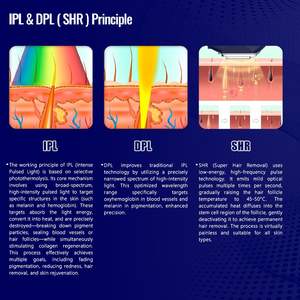 Appareil de beauté pour le visage et le corps KES Lazer, équipement de beauté pour les pigments, l'acné, les vaisseaux sanguins, 11 filtres, IPL DPL, machine d'épilation au laser - Product Image 6