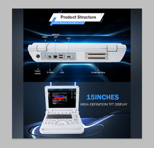 Ультразвуковая система для ноутбука - Product Image 2