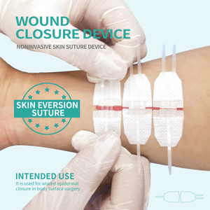 Fabrika doğrudan tedarik Zip dikiş tek paket tıbbi yara cilt kapatma cihazı cerrahi dikişler yara bakımı - Product Image 4