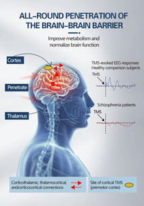Crema de Terapia de Microcorriente para Estimulación Transcraneal - Material ABS Transpirable con Características de Seguridad, Enchufe Europeo, Producto de Cuidado que Mejora la Salud - Product Image 4
