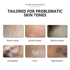 <span class=keywords><strong>Dermographe</strong></span> maquillage Permanent, Microblading, tatouage, Camouflage de peau pour couvrir les cicatrices, tatouage et stries, stries de graisse à enlever - Product Image 6