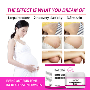 Özel Marka Hamilelik Cilt Bakımı En İyi Çatlak İzi Giderici Krem Meydanotu Kökü Ekstresi ile Esneklik Sağlayan Vücut Kremi - Product Image 4